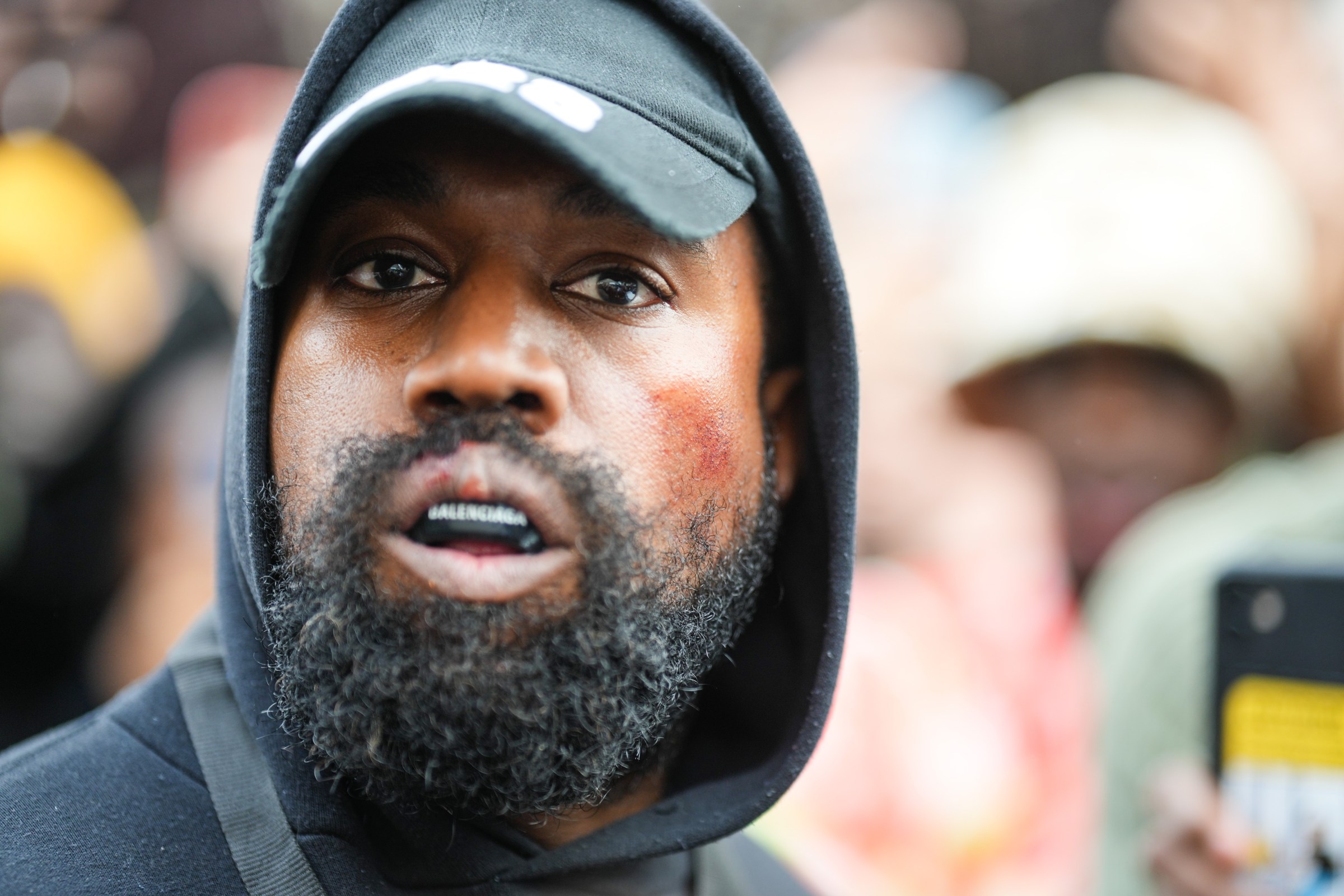 Kanye West’s antisemitic spiral, explained