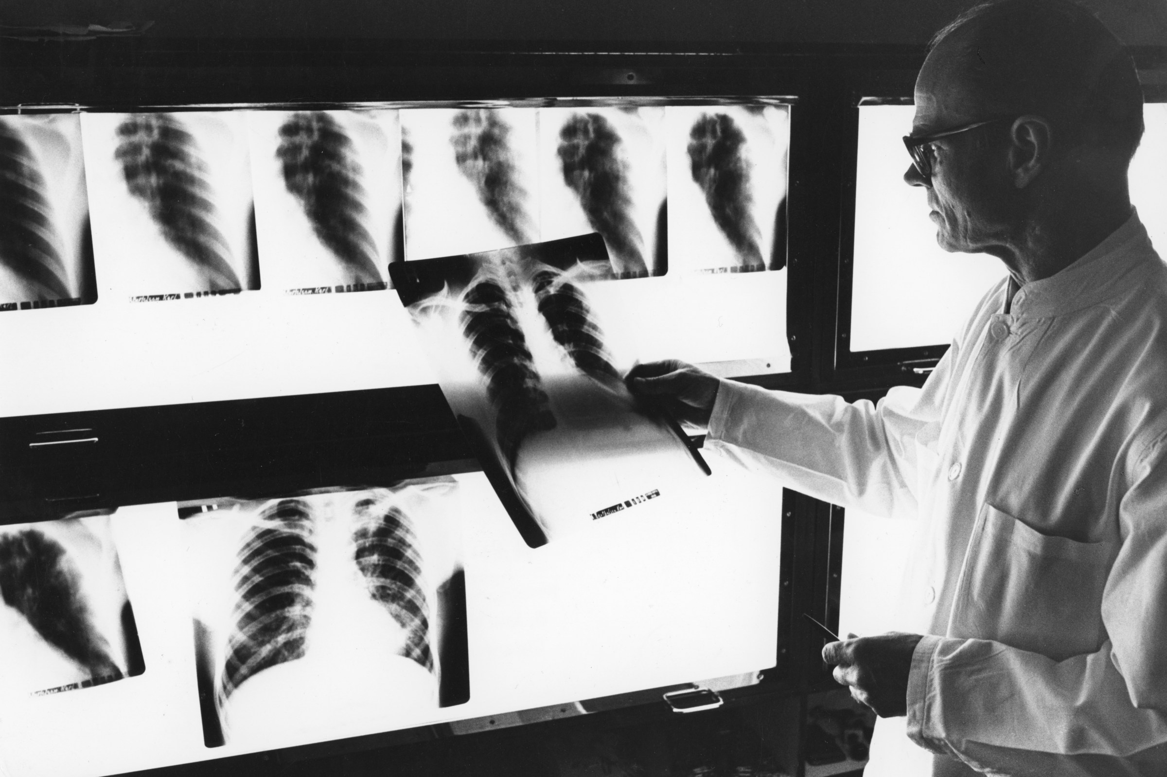 More than 1 million people die of tuberculosis every year. They don’t have to.