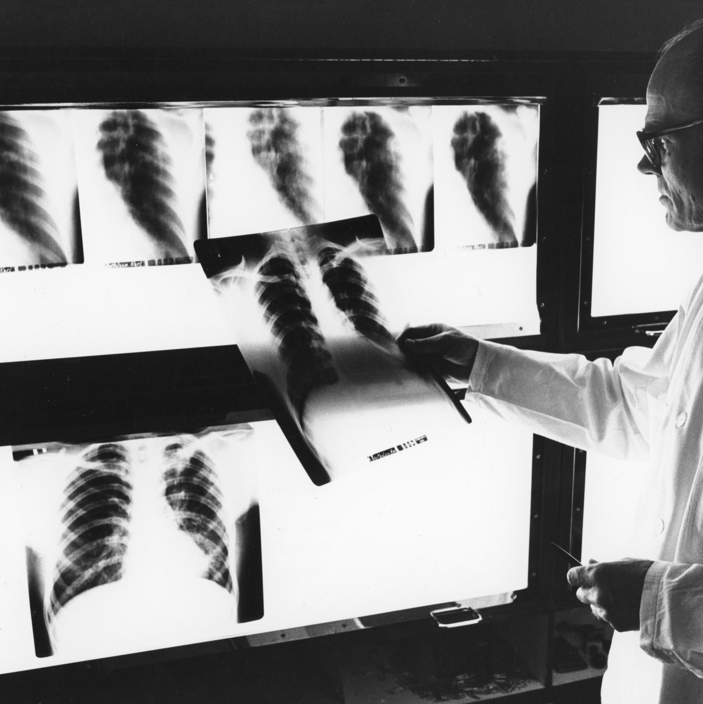 More than 1 million people die of tuberculosis every year. They don’t have to.